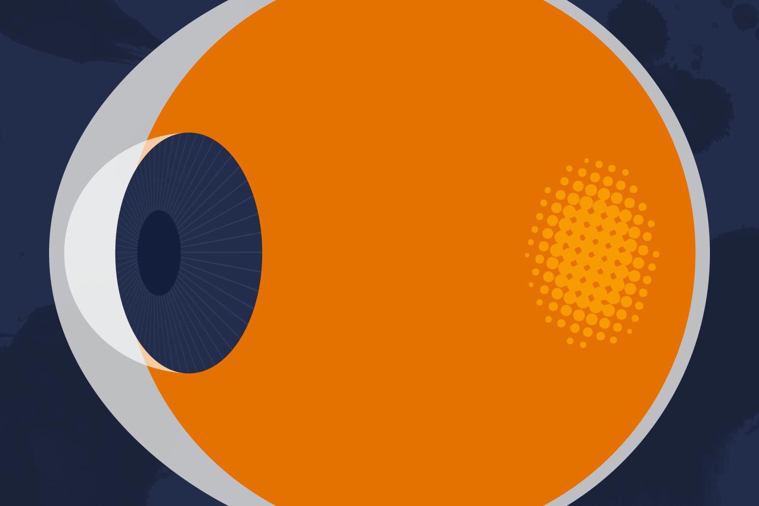 Illustration of an eye
